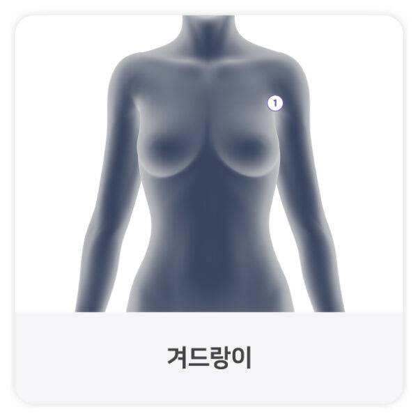 다한증1-100