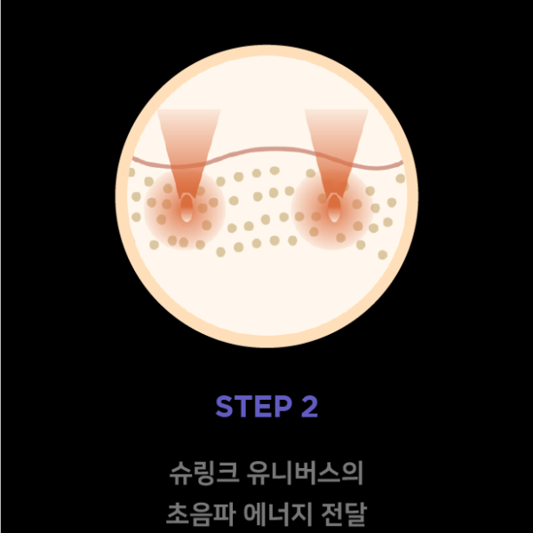 슈링크_원리2