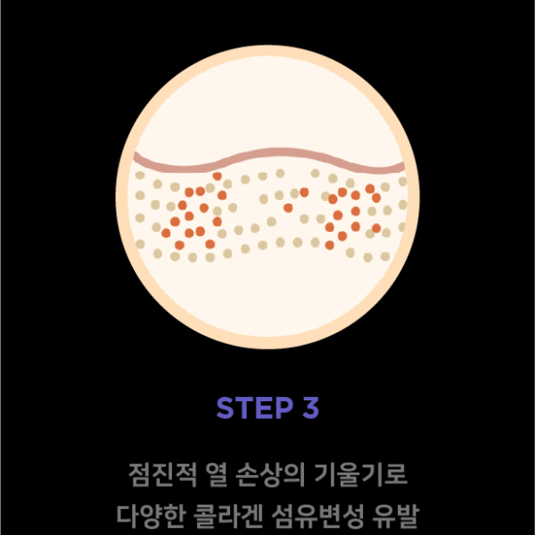 슈링크_원리3