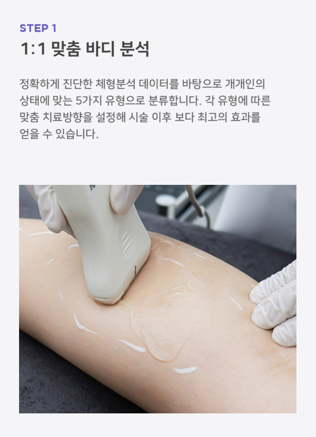 M_과정1_종아리보톡스