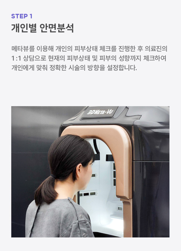 초음파보톡스_시술과정_모바일_1